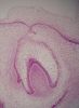 Filename=Toothbud11-17-05.jpg
Filesize=412KiB
Dimensions=897x1219
Date added=Oct 17, 2025 Toothbud11-17-05.jpg
