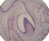 Filename=Toothbud11-19-05.jpg
Filesize=655KiB
Dimensions=1511x1299
Date added=Oct 18, 2025 Toothbud11-19-05.jpg