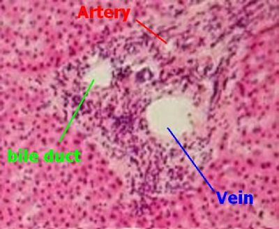 Liver portal triad (labels) - histology slide
Title: "Portal triad.JPG"

File used/downloaded for this slide (Portal triad.JPG): [url=https://commons.wikimedia.org/wiki/File:Portal_triad.JPG]https://commons.wikimedia.org/wiki/File:Portal_triad.JPG[/url]

No changes were made to the original image downloaded (Portal triad.JPG).

Uploaded by [url=https://commons.wikimedia.org/wiki/User:Reytan]Reytan[/url] from the Department of Histology, Jagiellonian University Medical College, and edited by [url=https://commons.wikimedia.org/wiki/User:T-310]T-310[/url]

Source: [url=https://commons.wikimedia.org/wiki/File:Human_liver.jpg]Image:Human liver.jpgon[/url] wikimedia commons by GFDL.

Permission is granted to copy, distribute and/or modify this document under the terms of the GNU Free Documentation License, Version 1.2 or any later version published by the Free Software Foundation; with no Invariant Sections, no Front-Cover Texts, and no Back-Cover Texts. A copy of the license is included in the section entitled GNU Free Documentation License. [url=https://commons.wikimedia.org/wiki/Commons:GNU_Free_Documentation_License,_version_1.2]https://commons.wikimedia.org/wiki/Commons:GNU_Free_Documentation_License,_version_1.2[/url]

This file is licensed under the Creative Commons Attribution-Share Alike 3.0 Unported License [url=https://creativecommons.org/licenses/by-sa/3.0/deed.en/]https://creativecommons.org/licenses/by-sa/3.0/deed.en/[/url]


