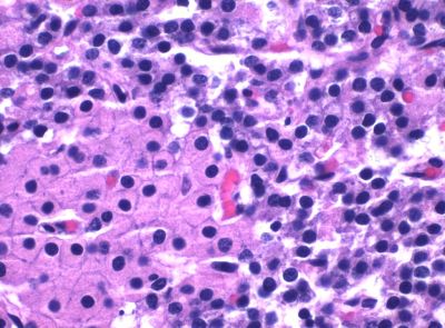 Parathyroid gland - histology slide
This is a histology slide of the parathyroid gland,.

Histology slide courtesy of Mikael Häggström, MD. and Wikimedia Commons. No changes were made from the download.

This file is made available under the Creative Commons CC0 1.0 Universal Public Domain Dedication (https://creativecommons.org/publicdomain/zero/1.0/deed.en).

