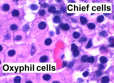 Parathyroid gland (labels) - histology slide
This is a histology slide of the parathyroid gland.

Histology slide courtesy of Mikael Häggström, MD. and Wikimedia Commons. No changes were made from the download.

This file is made available under the Creative Commons CC0 1.0 Universal Public Domain Dedication (https://creativecommons.org/publicdomain/zero/1.0/deed.en).

