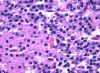 1024px-Parathyroid_oxyphil_and_chief_cells.jpg
