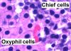 Parathyroid_oxyphil_and_chief_cells_-_annotated.jpg