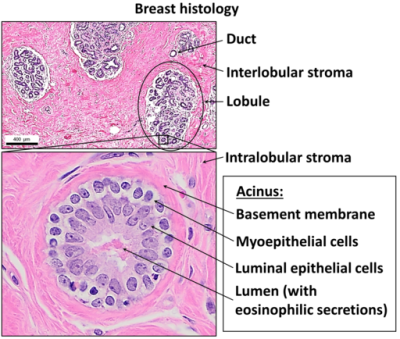 Normal breast (labels) – histology slide
This is a histology slide of normal breast. 

Histology slide courtesy of Mikael Häggström, M.D., via Wikimedia Commons. No changes were made from the download.  

Original file source: [url=https://commons.wikimedia.org/wiki/File:Normal_breast_histology.png]https://commons.wikimedia.org/wiki/File:Normal_breast_histology.png[/url]

This file is licensed under the Creative Commons Attribution-Share Alike 4.0 International license. [url=https://creativecommons.org/licenses/by-sa/4.0/deed.en/]https://creativecommons.org/licenses/by-sa/4.0/deed.en/[/url]
