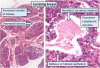 Filename=512px-Histology_of_lactating_breast2C_annotated.png
Filesize=387KiB
Dimensions=512x349
Date added=Oct 08, 2025 512px-Histology_of_lactating_breast2C_annotated.png