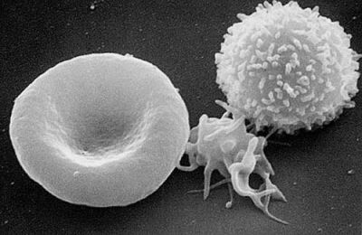 Blood - SEM
A three-dimensional ultrastructural image analysis of a T-lymphocyte (right), a platelet (center) and a red blood cell (left), using a Hitachi S-570 scanning electron microscope (SEM) equipped with a GW Backscatter Detector. (Description text from the Wikimedia Commons file page.)

Image courtesy of Electron Microscopy Facility at The National Cancer Institute at Frederick (NCI-Frederick), via Wikimedia Commons.
Keywords: blood