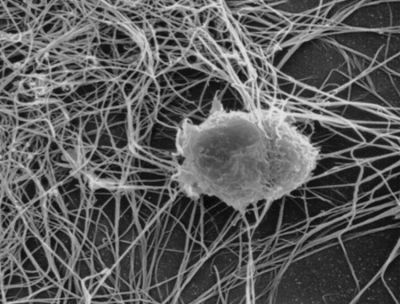 Follicular dendritic cell - SEM
This is an isolated Follicular Dendritic Cell cultured on collagen. It shows a cell body and numerous dendritic cell processes interdigitating with one another and with dendrites of adjacent FDCs to form a network. This network traps antigen in the form of immune complexes and helps initiate an antibody response by B cells. For further information see Wikiversity: Follicular Dendritic Cells. (Description text from the Wikimedia Commons file page.)

Source: Own work by uploader [Aszakal]; Virginia Commonwealth University Medical School, Dept. of Anatomy and Neuroscience
Image by Aszakal, via Wikimedia Commons. 

Original file source: [url=https://commons.wikimedia.org/wiki/File:Follicular_Dendritic_Cell.jpg]https://commons.wikimedia.org/wiki/File:Follicular_Dendritic_Cell.jpg[/url]

Title: "Follicular_Dendritic_Cell.jpg"

No changes were made to the original image downloaded. 

This file is licensed under the Creative Commons Attribution-ShareAlike 3.0 Unported License (CC BY-SA 3.0) [url=https://creativecommons.org/licenses/by-sa/3.0/deed.en/]https://creativecommons.org/licenses/by-sa/3.0/deed.en/[/url]

Permission is granted to copy, distribute and/or modify this document under the terms of the GNU Free Documentation License, Version 1.2 or any later version published by the Free Software Foundation; with no Invariant Sections, no Front-Cover Texts, and no Back-Cover Texts. A copy of the license is included in the section entitled GNU Free Documentation License. [url=https://commons.wikimedia.org/wiki/Commons:GNU_Free_Documentation_License,_version_1.2]https://commons.wikimedia.org/wiki/Commons:GNU_Free_Documentation_License,_version_1.2[/url]
Keywords: node spleen