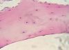 Filename=Cartilage.jpg
Filesize=8KiB
Dimensions=237x174
Date added=Oct 19, 2025 Cartilage.jpg