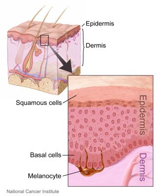 Skin (labels) - illustration
The layers of the skin (epidermis and dermis), as well as an inset with a close-up view of the types of cells in the skin (squamous cells, basal cells, and melanocytes). (Description from the National Cancer Institute Visuals Online page.)

Title: Layers of the Skin

Image and description: [url=https://visualsonline.cancer.gov/details.cfm?imageid=4366] https://visualsonline.cancer.gov/details.cfm?imageid=4366[/url]

Originator: NCI

Source: The Web site of the National Cancer Institute ([url=https://www.cancer.gov]https://www.cancer.gov[/url])

Creator: Don Bliss (Illustrator)

