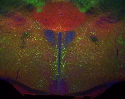 Calretinin and DAPI – histology slide
The hypothalamus from a D2-eGFP (green) transgenic mouse stained for calretinin (red) and DAPI to show nuclei. 

Creator: Margaret I. Davis 

Photo Source: National Institutes of Health (NIH), via Wikimedia Commons

Usage: No changes were made from the download from Wikimedia Commons.  

File URL: https://commons.wikimedia.org/wiki/File%3AHypothalamus_calretinin_nuclei.jpg?utm_source=chatgpt.com

