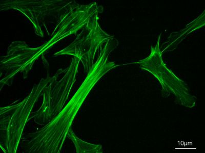 FITC-phalloidin
Microfilament (actin cytoskeleton) of mouse embryo fibroblasts, stained with FITC-phalloidin (100-fold magnification.)

Histology slide courtesy of Y tambe and Wikimedia Commons. No changes were made from the download.

Original file source
https://commons.wikimedia.org/wiki/File:MEF_microfilaments.jpg

Permission is granted to copy, distribute and/or modify this document under the terms of the GNU Free Documentation License, Version 1.2 or any later version published by the Free Software Foundation; with no Invariant Sections, no Front-Cover Texts, and no Back-Cover Texts. A copy of the license is included in the section entitled GNU Free Documentation License.

This file is licensed under the Creative Commons Attribution-Share Alike 3.0 Unported license. 

This file is licensed under the Creative Commons Attribution-Share Alike 2.5 Generic, 2.0 Generic and 1.0 Generic license.

CC BY-SA 3.0 Unported
https://creativecommons.org/licenses/by-sa/3.0/deed.en

CC BY-SA 2.5
Generic: https://creativecommons.org/licenses/by-sa/2.5/deed.en

CC BY-SA 2.0
https://creativecommons.org/licenses/by-sa/2.0/deed.en

CC BY-SA 1.0
https://creativecommons.org/licenses/by-sa/1.0/deed.
