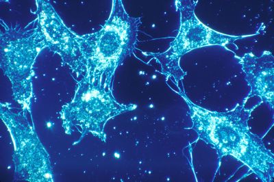 Darkfield microscopy
Shown is normal cells of human connective tissue in culture. At a magnification of 500x, the cells were illuminated by darkfield amplified contrast technique.

Image courtesy of Dr. Cecil Fox (photographer)/National Cancer Institute.
