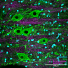 512px-Spinal_cord_gray_matter_immunofluorescence_staining2C_confocal_imaging.png