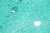 Liver_reticulin.jpg