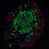 Pancreaticislet.jpg
