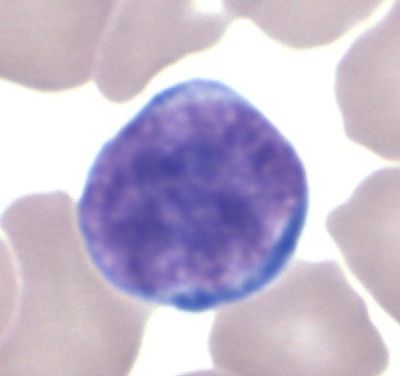Lymphocyte - histology slide
Image by Dr Glenn Littel, via Wikimedia Commons. 

Original file source: [url=https://commons.wikimedia.org/wiki/File:Lymphocyte_GL.jpg]https://commons.wikimedia.org/wiki/File:Lymphocyte_GL.jpg[/url]

Title: "Lymphocyte GL.jpg"

No changes were made to the original image downloaded.  

Permission is granted to copy, distribute and/or modify this document under the terms of the GNU Free Documentation License, Version 1.2 or any later version published by the Free Software Foundation; with no Invariant Sections, no Front-Cover Texts, and no Back-Cover Texts. A copy of the license is included in the section entitled GNU Free Documentation License. [url=https://commons.wikimedia.org/wiki/Commons:GNU_Free_Documentation_License,_version_1.2]https://commons.wikimedia.org/wiki/Commons:GNU_Free_Documentation_License,_version_1.2[/url]

This file is licensed under the Creative Commons Attribution-Share Alike 3.0 Unported License [url=https://creativecommons.org/licenses/by-sa/3.0/deed.en/]https://creativecommons.org/licenses/by-sa/3.0/deed.en/[/url]



