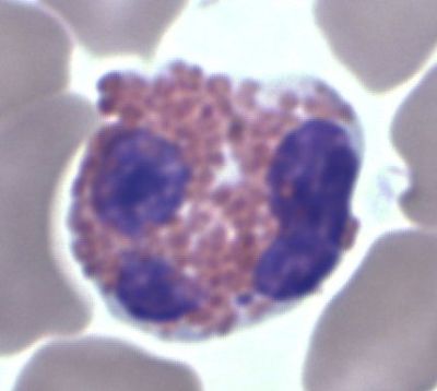 Eosinophil - histology slide
Image by Dr Glenn Littel, via Wikimedia Commons. 

Original file source: [url=https://commons.wikimedia.org/wiki/File:WBC_eosinophil.jpg] https://commons.wikimedia.org/wiki/File:WBC_eosinophil.jpg[/url]

Title: "WBC eosinophil.jpg "

No changes were made to the original image downloaded.  

Permission is granted to copy, distribute and/or modify this document under the terms of the GNU Free Documentation License, Version 1.2 or any later version published by the Free Software Foundation; with no Invariant Sections, no Front-Cover Texts, and no Back-Cover Texts. A copy of the license is included in the section entitled GNU Free Documentation License. [url=https://commons.wikimedia.org/wiki/Commons:GNU_Free_Documentation_License,_version_1.2]https://commons.wikimedia.org/wiki/Commons:GNU_Free_Documentation_License,_version_1.2[/url]

This file is licensed under the Creative Commons Attribution-Share Alike 3.0 Unported License [url=https://creativecommons.org/licenses/by-sa/3.0/deed.en/]https://creativecommons.org/licenses/by-sa/3.0/deed.en/[/url]

This file is licensed under the Creative Commons Attribution-ShareAlike [url=https://creativecommons.org/licenses/by-sa/2.5/deed.en]2.5 Generic[/url], [url=https://creativecommons.org/licenses/by-sa/2.0/deed.en]2.0 Generic[/url] and [url=https://creativecommons.org/licenses/by-sa/1.0/deed.en]1.0 Generic[/url] license.
