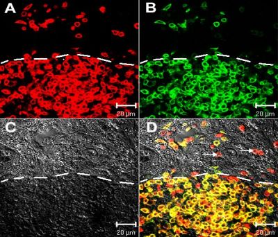 Pineal gland, chicken – immuno-staining
Distribution of CD3+ and CD4+ cells. PALT stained with anti-CD3 (panel A) and anti-CD4 (panel B). Note that the majority of the lymphocytes are double positive for CD3 and CD4 (yellow in Panel D). Several CD3+/CD4- cells are seen primarily along the periphery of the PALT and bordering a pineal follicle (arrows, Panel D). The DIC image (Panel C) shows the border of the PALT (white dashed line).

Citation: Mosenson, J.A., McNulty, J.A. Characterization of lymphocyte subsets over a 24-hour period in Pineal-Associated Lymphoid Tissue (PALT) in the chicken. BMC Immunol 7, 1 (2006). https://doi.org/10.1186/1471-2172-7-1

Source: [url=https://bmcimmunol.biomedcentral.com/articles/10.1186/1471-2172-7-1]BMC Immunology article[/url]

Image title: "Figure 3"

No changes were made to the original image downloaded.  

This image and descriptive text are from an article published by [i]BioMed Central Ltd[/i]. It is an Open Access article distributed under the terms of the [url=https://creativecommons.org/licenses/by/2.0]Creative Commons Attribution License (CC BY 2.0)[/url], which permits unrestricted use, distribution, and reproduction in any medium, provided the original work is properly cited.  

Keywords: pineal