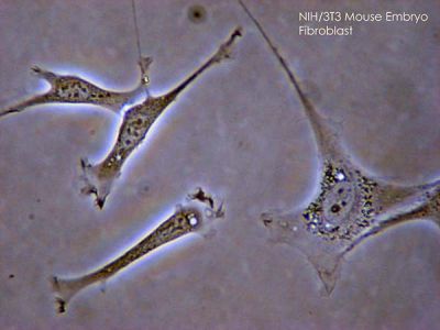 Fibroblasts, mouse embryo
Fibroblasts seen with phase contrast microscopy.

Courtesy of SubtleGuest and Wikimedia Commons. No changes made.

Licenses:
CC-BY-SA  3.0 (https://creativecommons.org/licenses/by-sa/3.0/deed.en) 

CC BY 2.5 (https://creativecommons.org/licenses/by/2.5/deed.en)

GNU Free Documentation License, Version 1.2 or any later version; with no Invariant Sections, no Front-Cover Texts, and no Back-Cover Texts. https://commons.wikimedia.org/wiki/Commons:GNU_Free_Documentation_License,_version_1.2

Keywords: fetal, connective, fibers