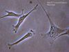 Fibroblast.jpg