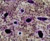 Filename=Compact_bone_-_ground_cross_section.jpg
Filesize=120KiB
Dimensions=649x537
Date added=Oct 05, 2025 Compact_bone_-_ground_cross_section.jpg