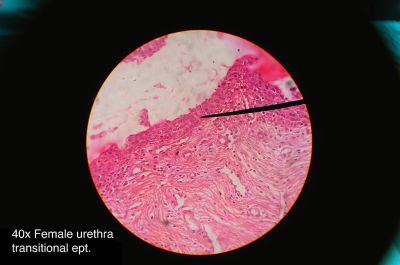 Urethra, female - histology slide
This is a histology slide of the urethra (female)  The arrow is pointing to transitional epithelium.

Histology slide courtesy of Athikhun.suw and Wikimedia Commons. No changes were made from the download.

This file is licensed under the  Creative Commons Attribution-Share Alike 4.0 International license (https://creativecommons.org/licenses/by-sa/4.0/deed.en) 

