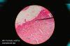 Female_urethra_histology.jpg