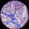 512px-Thyroid_gland_microscope.jpg