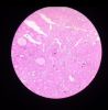 Filename=Histology_of_Thyroid_gland.jpg
Filesize=289KiB
Dimensions=720x728
Date added=Oct 13, 2025 Histology_of_Thyroid_gland.jpg