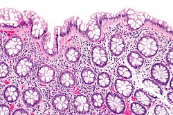 Rectum - histology slide
This is a histology slide of the rectum.

Histology slide courtesy of nephron and Wikimedia Commons. No changes were made from the download. 

This file is licensed under the Creative Commons Attribution-Share Alike 3.0 Unported license (https://creativecommons.org/licenses/by-sa/3.0/deed.en)

