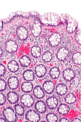 Rectum - histology slide
This is a histology slide of the rectum.

Histology slide courtesy of nephron and Wikimedia Commons. No changes were made from the download. 

This file is licensed under the Creative Commons Attribution-Share Alike 3.0 Unported license (https://creativecommons.org/licenses/by-sa/3.0/deed.en)

