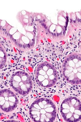 Rectum - histology slide
This is a histology slide of the rectum.

Histology slide courtesy of nephron and Wikimedia Commons. No changes were made from the download.

This file is licensed under the Creative Commons Attribution-Share Alike 3.0 Unported license (https://creativecommons.org/licenses/by-sa/3.0/deed.en)

