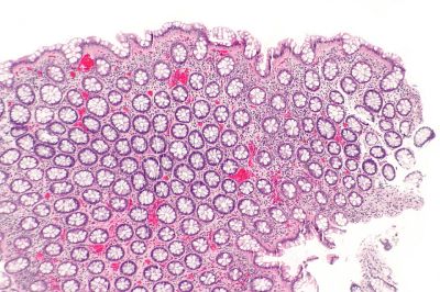 Rectum - histology slide
This is a histology slide of the rectum.

Histology slide courtesy of nephron and Wikimedia Commons. No changes were made from the download. 

This file is licensed under the Creative Commons Attribution-Share Alike 3.0 Unported license (https://creativecommons.org/licenses/by-sa/3.0/deed.en)

