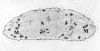 Chondrocyte-_calcium_stain.jpg