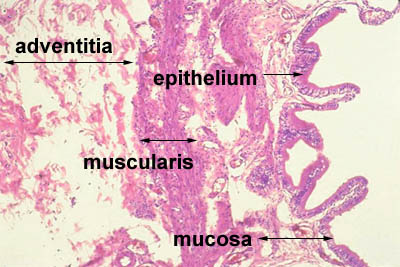 gallbladder histology labeled