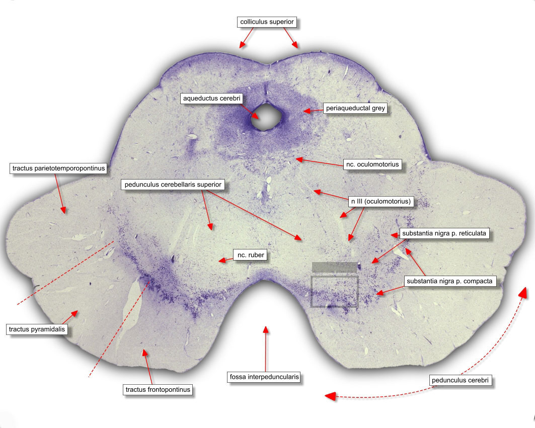 histology_mesencephalon_01_lb.jpg