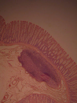 Large Intestine Histology Large Intestine Histology Slide