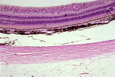 histological slide of normal retina