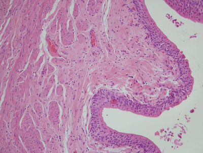 labeled ureter slide