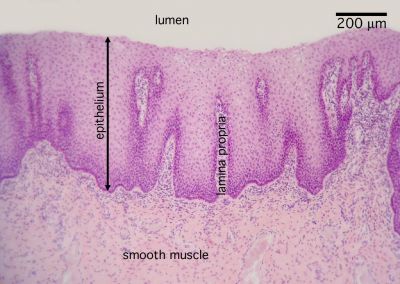 nonkeratinized stratified squamous epithelium slide