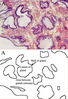 411px-Prostatehistology.jpg