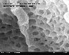 750px-Inner_view_of_fenestrae_in_capillary_of_glomerulus_in_Scanning_Electron_Microscope%2C_magnification_100%2C000x.gif
