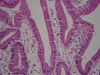 800px-Microvilli-Duodenum.jpg