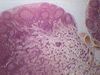 LymphNode-40x-2.jpg