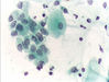 Pap_test_endocervical_cells.jpg