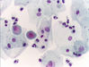 Urine_normal_cytology.jpg