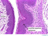 Filename=cervix20x~0.jpg
Filesize=350KiB
Dimensions=800x598
Date added=Sep 06, 2007 cervix20x~0.jpg