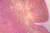 Filename=esophagus1.jpg
Filesize=245KiB
Dimensions=768x512
Date added=Mar 22, 2007 esophagus1.jpg
