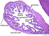gallbladder10x.jpg