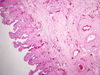 gallbladder1~0.jpg